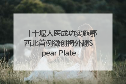 十堰人医成功实施鄂西北首例微创拇外翻Spear Plate髓内板矫形术