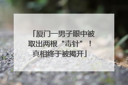 厦门一男子眼中被取出两根“毒针”！真相终于被揭开